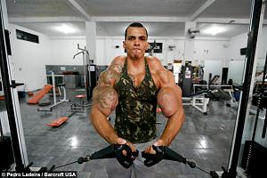 Muscle Injections Almost Cost This Man His Arms-e29e8fbe-6879-4805-ba27-4411c68d78db-jpg
